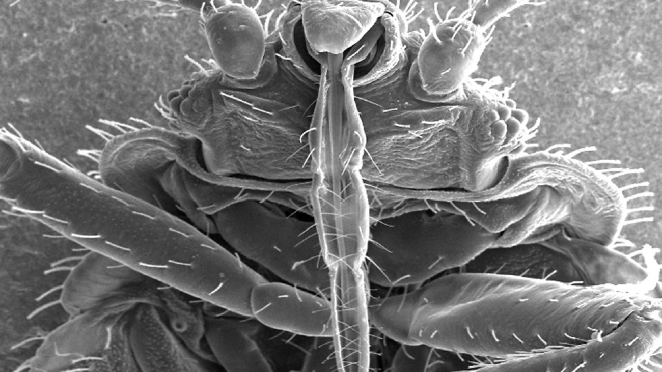 16710-microscopic-bedbug-scanning-electron-micrograph-pv